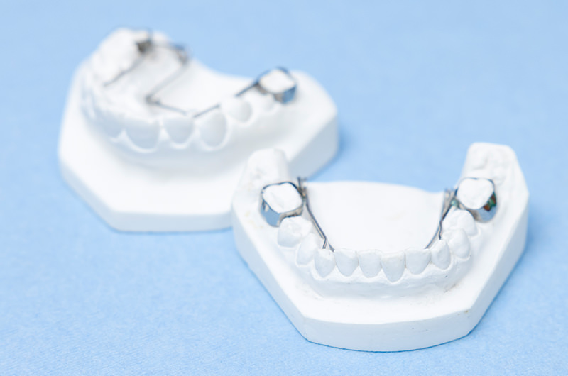 歯列矯正の様々な症例へ対応した実績